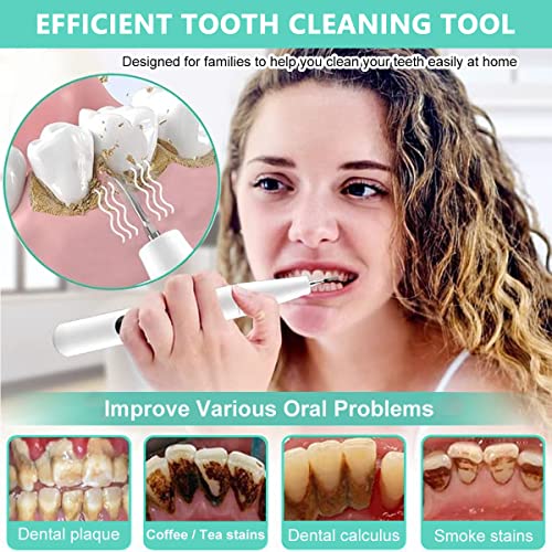 HANNEA Ultrasonic Plaque Remover Electric Plaque Remover with 480P Camera, 3 Working Modes, Cordless Electric Plaque Remover with 2 Bits and Oral Mirror, Remove Teeth Stain Tartar Plaque Calculus HANNEA Ultrasonic Plaque Remover Electric Plaque Remover with 480P Camera, 3 Working Modes, Cordless Electric Plaque Remover with 2 Bits and Oral Mirror, Remove Teeth Stain Tartar Plaque Calculus
